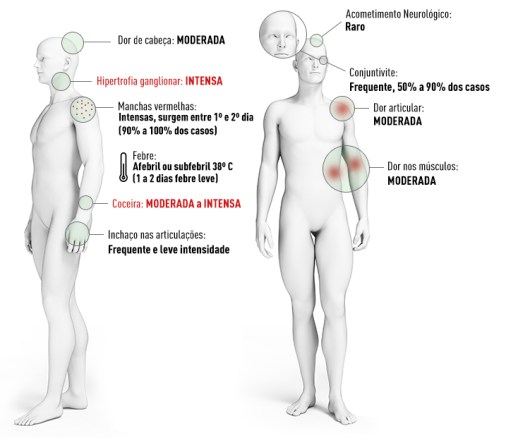 SINTOMAS-zika-140716